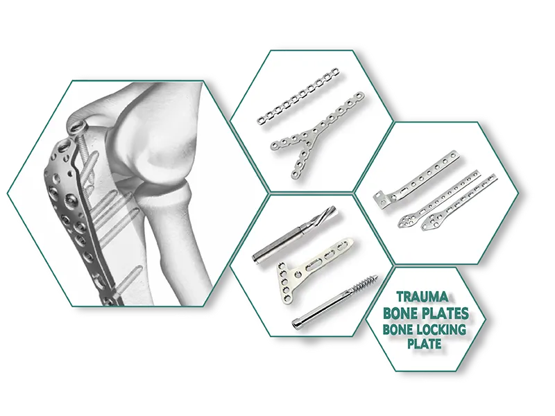 Orthopaedic Implants